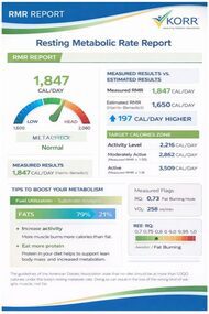 Fitness tracker displaying daily activity and health stats.