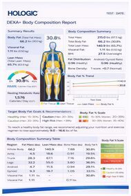 Full-body DEXA scan showing bone density and body composition analysis.